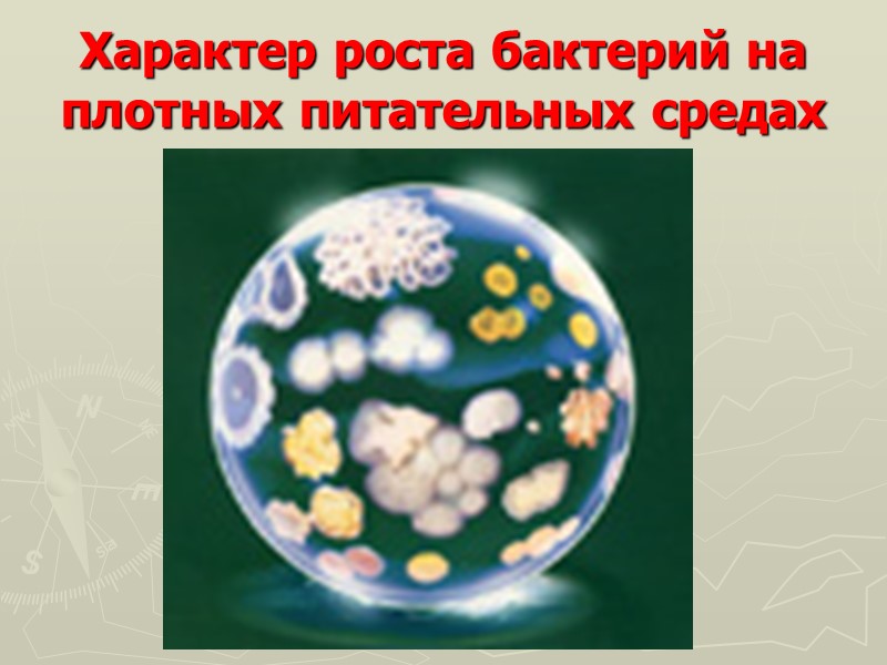 Характер роста бактерий на плотных питательных средах